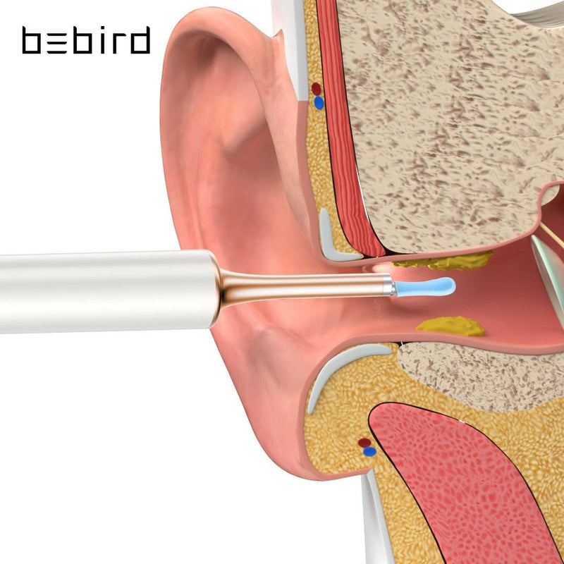 Bebird T15 X3: um limpador de ouvido - Kmelo120